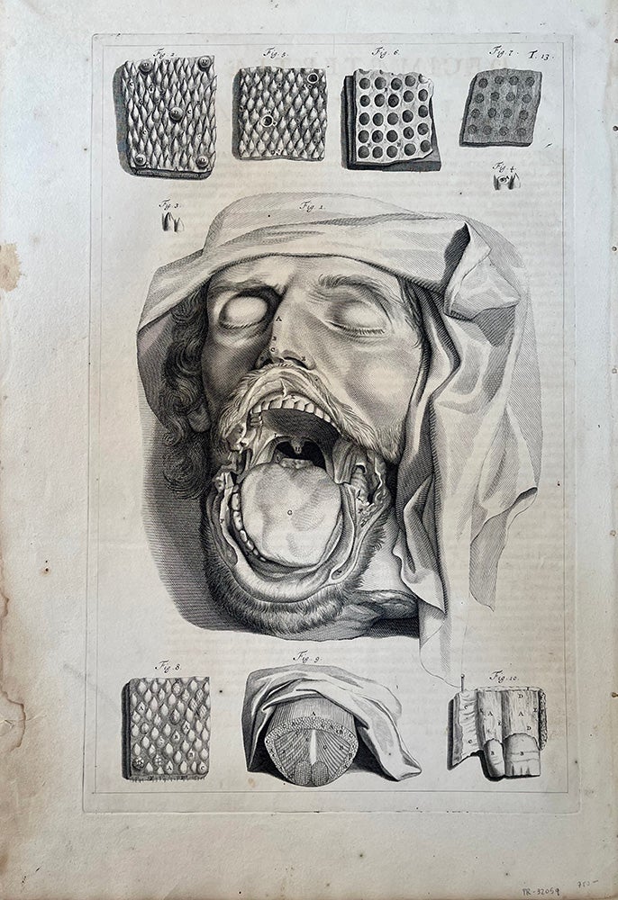 Book Id: 32059 Plate 13 (head w/dissected jaw & tongue) from Anatomia humani corporis. 44x27.5cm (image size) First edition. Govert Bidloo, Gerard de Lairesse.