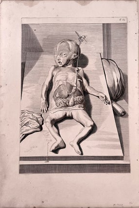 Book Id: 32060 Plate 62 (dissected fetus) from Anatomia humani...