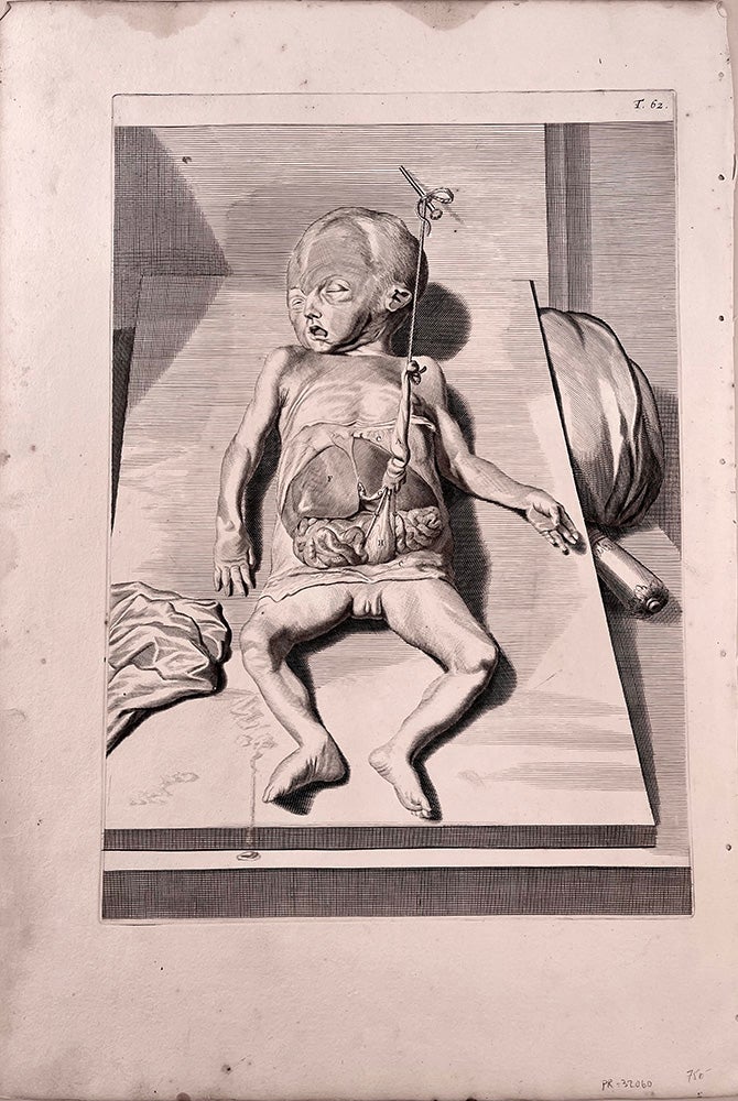 Book Id: 32060 Plate 62 (dissected fetus) from Anatomia humani corporis. 40 x 27.5cm (image size) in a trim of 51 x 35.5 cm. Govert Bidloo, Gerard de Lairesse.