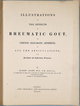 Illustrations of the effects of rheumatic gout. Atlas only. Robert Adams.