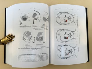 Rhinoplasty and Facial Plastic Surgery with a Supplement on Mammaplasty.; Milstein, Stanley, ed.