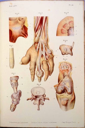 Book Id: 43448 Atlas d’anatomie pathologique. 2 vols. (text and atlas)....
