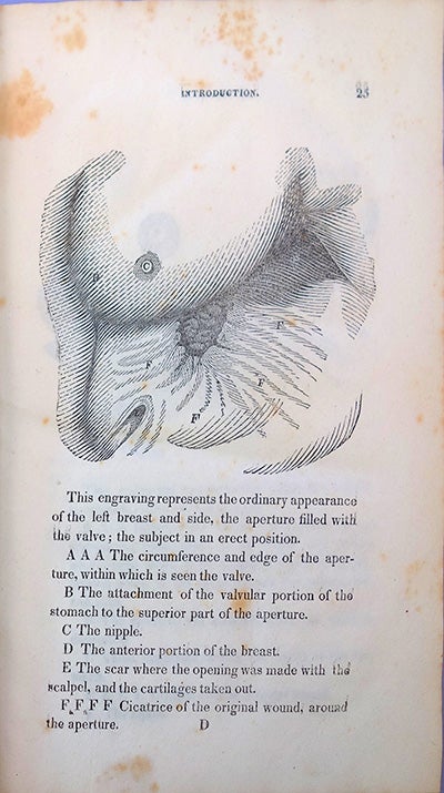 Experiments and observations on the gastric juice by William Beaumont on Jeremy Norman Co. Inc