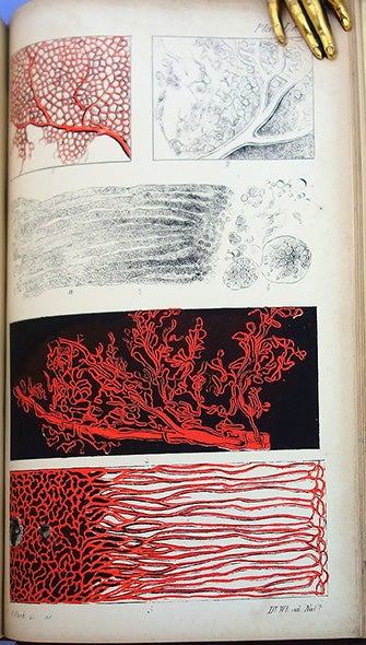Book Id: 43722 The microscopic anatomy of the human body, in health and disease. 2 vols. Arthur Hill Hassall.