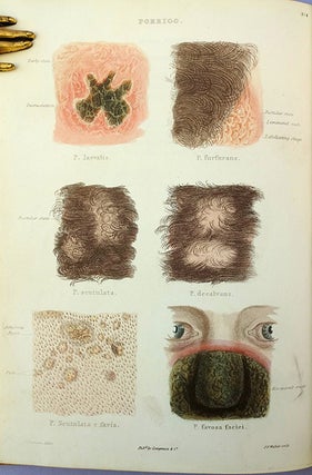 Atlas of delineations of cutaneous eruptions
