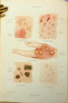 Atlas of delineations of cutaneous eruptions