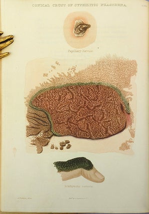 Atlas of delineations of cutaneous eruptions