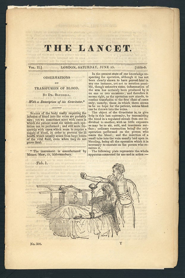 Book Id: 44358 Observations on transfusion of blood. In The Lancet 2 (1828-29): 321-24. James Blundell.