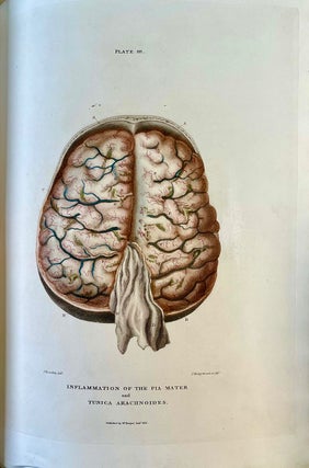 The morbid anatomy of the human brain . . . Second edition, expanded