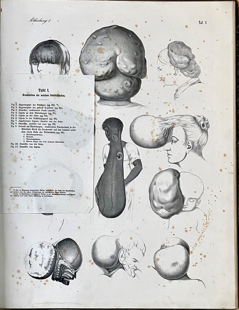 Book Id: 46944 Chirurgischer Atlas. Erste Abtheilung. Gehirn und Umhüllung. Vol. 1 only. Victor Bruns.
