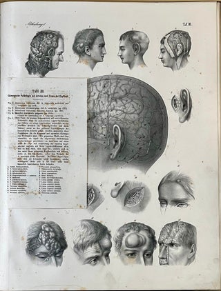 Chirurgischer Atlas. Erste Abtheilung. Gehirn und Umhüllung. Vol. 1 only.