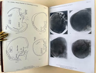 Röntgen-Diagnostik der Erkrankungen des Kopfes. Presentation inscription to Harvey Cushing.