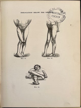 The mechanism of dislocation and fracture of the hip. Insc. to P. Ricord