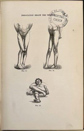 The mechanism of dislocation and fracture of the hip. Insc. to P. Ricord