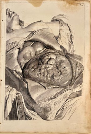Book Id: 51513 Plate 55 from Anatomia humani corporis. 522 x 358 mm. First...