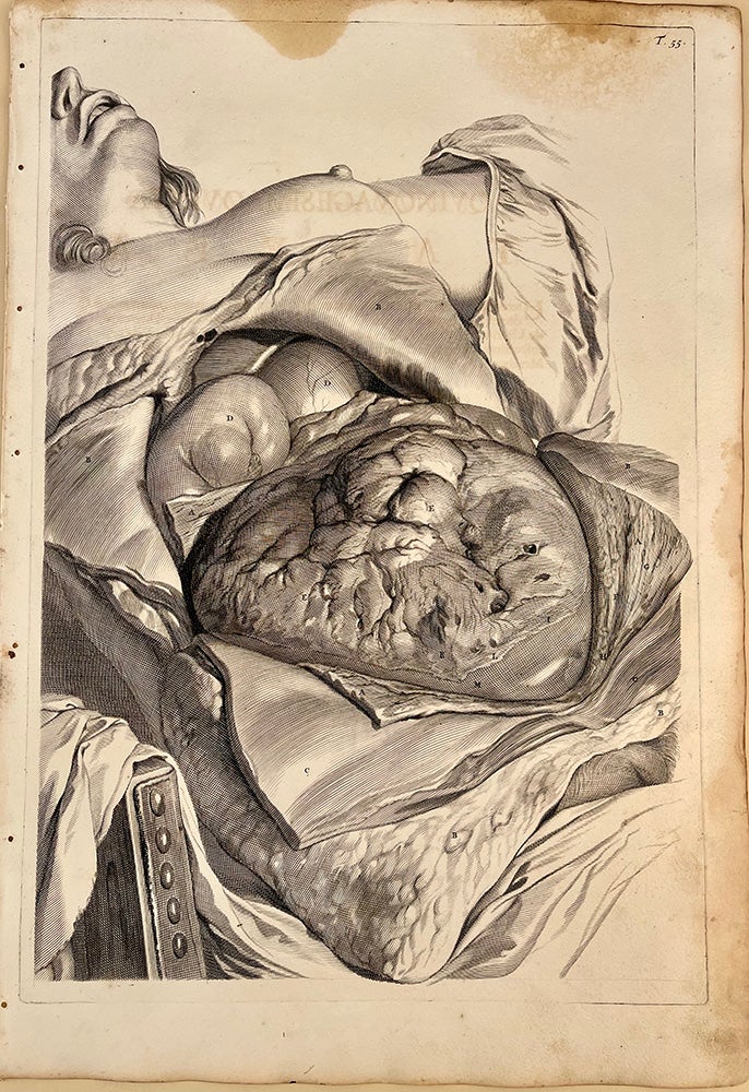Book Id: 51513 Plate 55 from Anatomia humani corporis. 522 x 358 mm. First edition. Stains in upper margin, but otherwise very good. Govert Bidloo, Gerard de Lairesse.