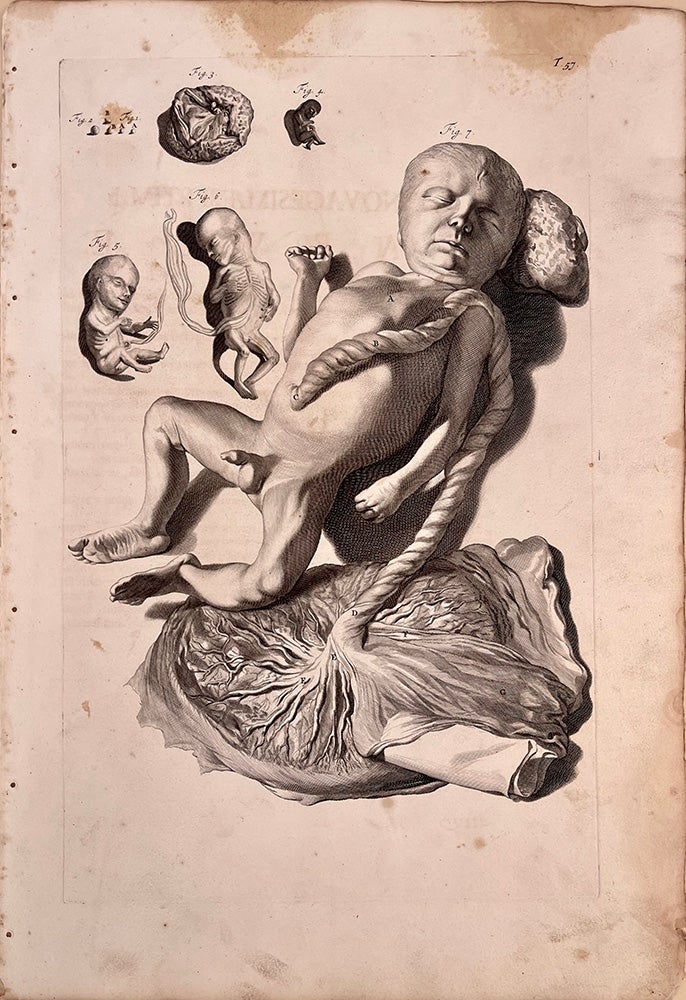 Book Id: 51521 Plate 57 from Anatomia humani corporis. 522 x 358 mm. First edition. Stains in upper margin, but otherwise very good. Govert &Gerard de Lairesse Bidloo.