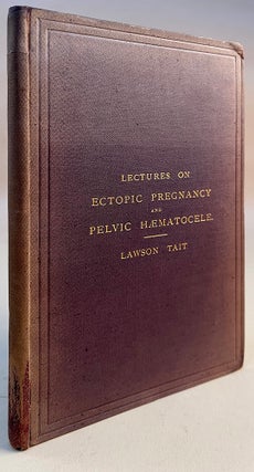 Lectures on ectopic pregnancy and pelvic haematocele. Pres. copy.