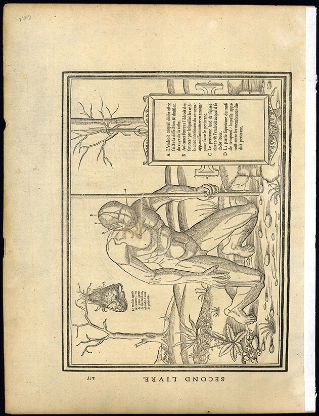 Book Id: 51816 Leaf with anatomical woodcuts from "La dissection des parties du corps humain" (pp. 255-256). Images on both pages. Charles Estienne.