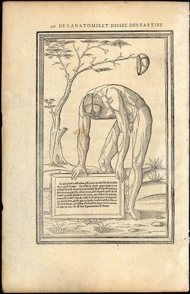 Leaf with anatomical woodcuts from "La dissection des parties du corps humain" (pp. 255-256). Images on both pages.