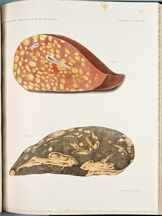 An Atlas of Illustrations of Clinical Medicine, Surgery, and Pathology