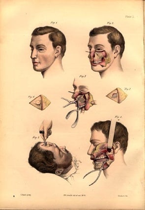 Book Id: 6715 A course of operative surgery. . . Christopher Heath